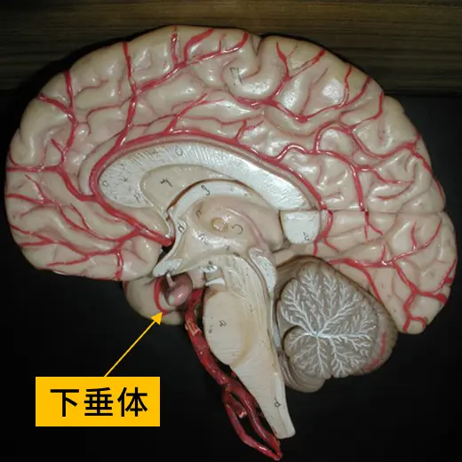 下垂体の模型とMRI
